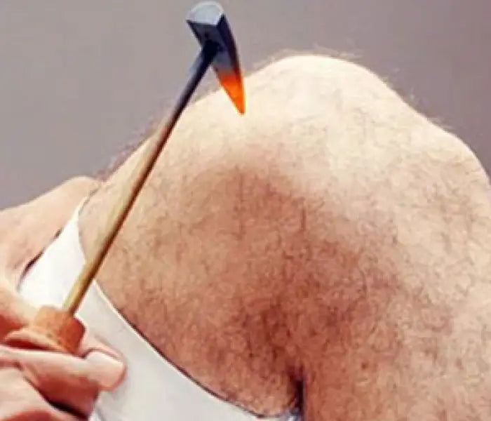 Agnikarma: Ancient Fire Therapy for Pain Relief