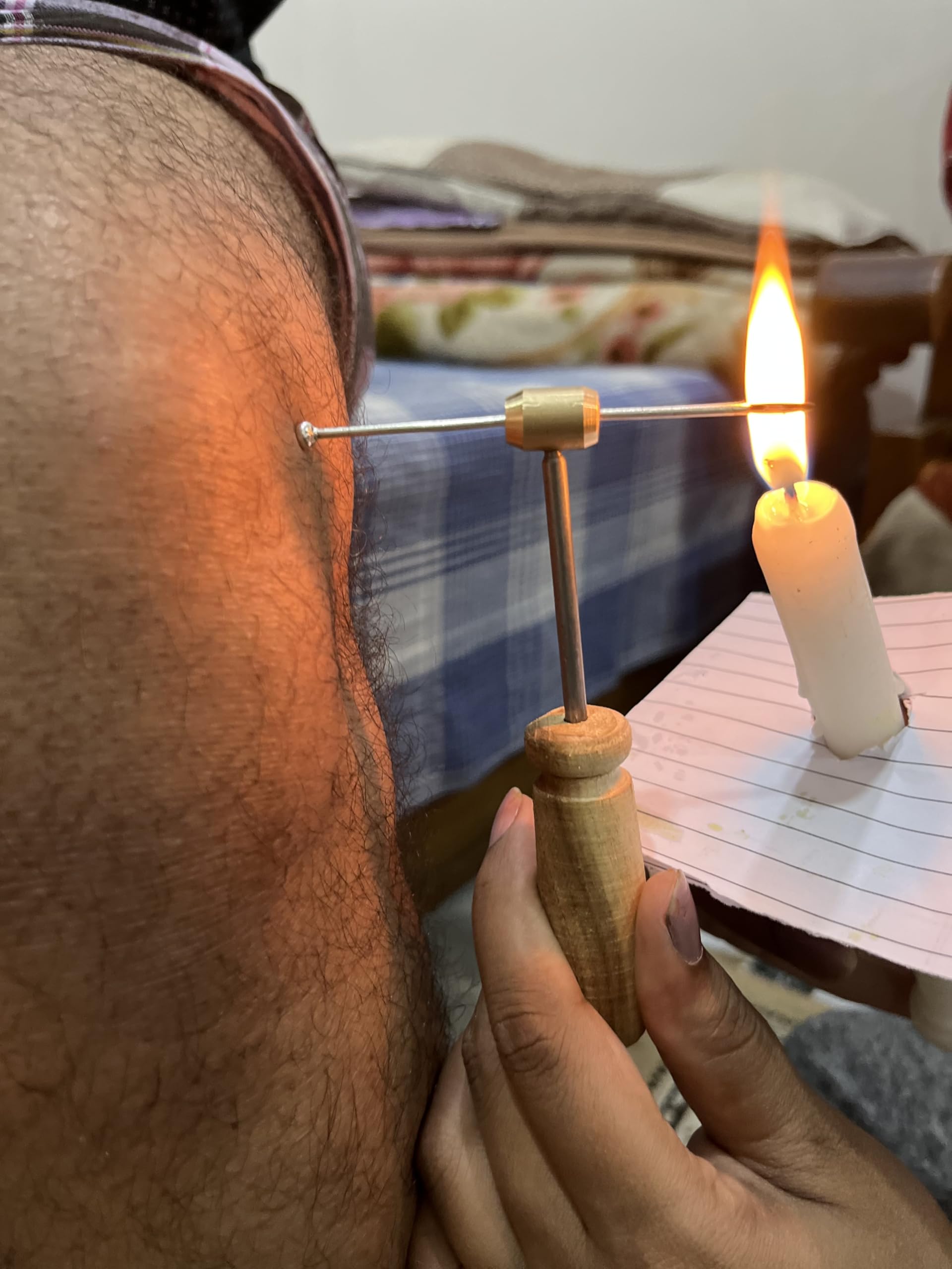 Rajat AGNIKARMA SWEDAN SHALAKA