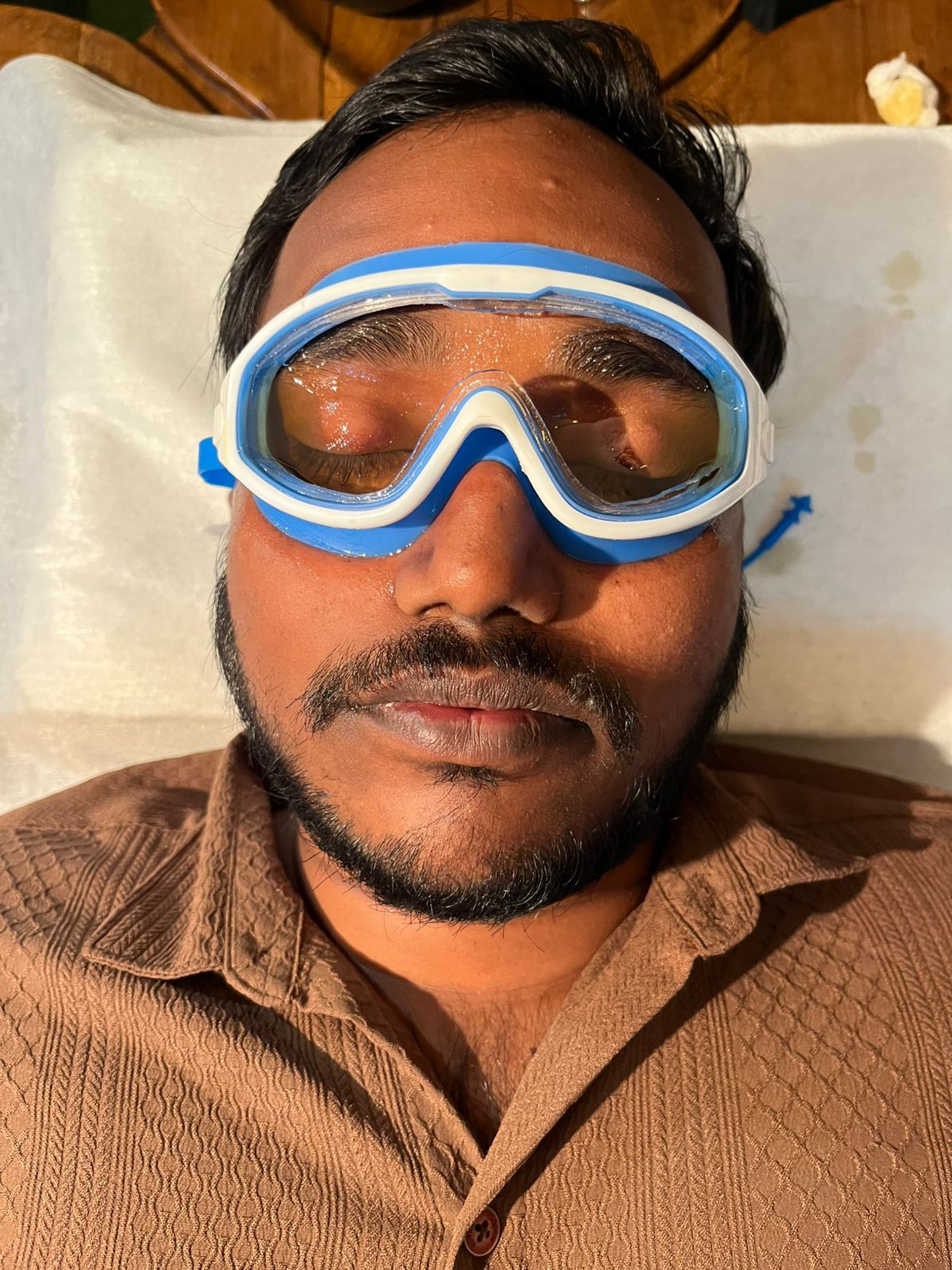 Netra Tarpan Goggles – Ayurvedic Eye Therapy